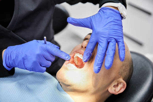 Best Chipped Tooth Repair Near Me  in Capitol View, SC